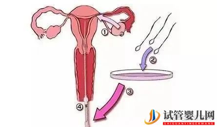 成功的女人,花50万做试管婴儿,试管过程你得知道(图12) 成功的女人,花50万做试管婴儿,试管过程你得知道(图12)