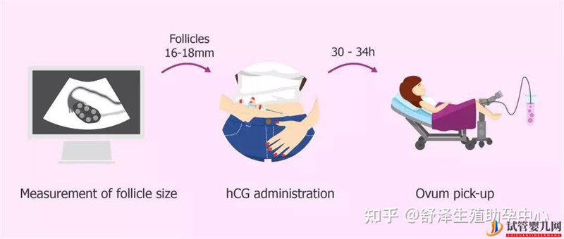 一个试管婴儿周期多长时间,具体流程怎么样(图5) 一个试管婴儿周期多长时间,具体流程怎么样(图5)