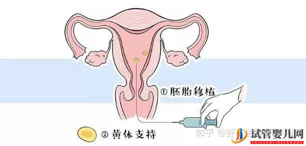一个试管婴儿周期多长时间,具体流程怎么样(图10) 一个试管婴儿周期多长时间,具体流程怎么样(图10)