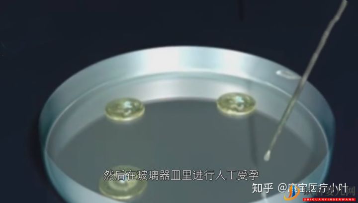 做试管婴儿有多痛,几张3D模拟图,看完全过程后心(图6) 做试管婴儿有多痛,几张3D模拟图,看完全过程后心(图6)