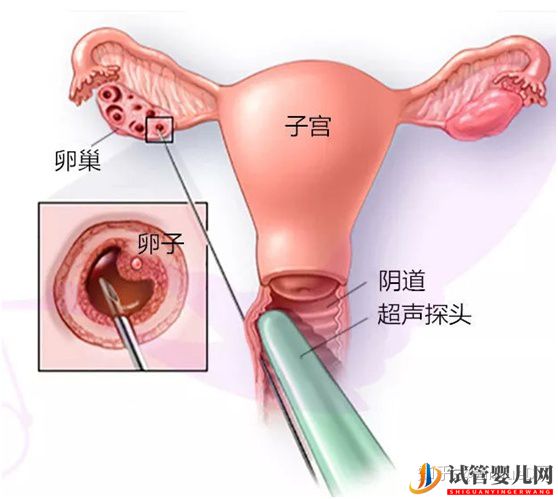 做试管卵泡正常内膜厚度多少才正常_90%的患者不知道(图3) 做试管卵泡正常内膜厚度多少才正常_90%的患者不知道(图3)