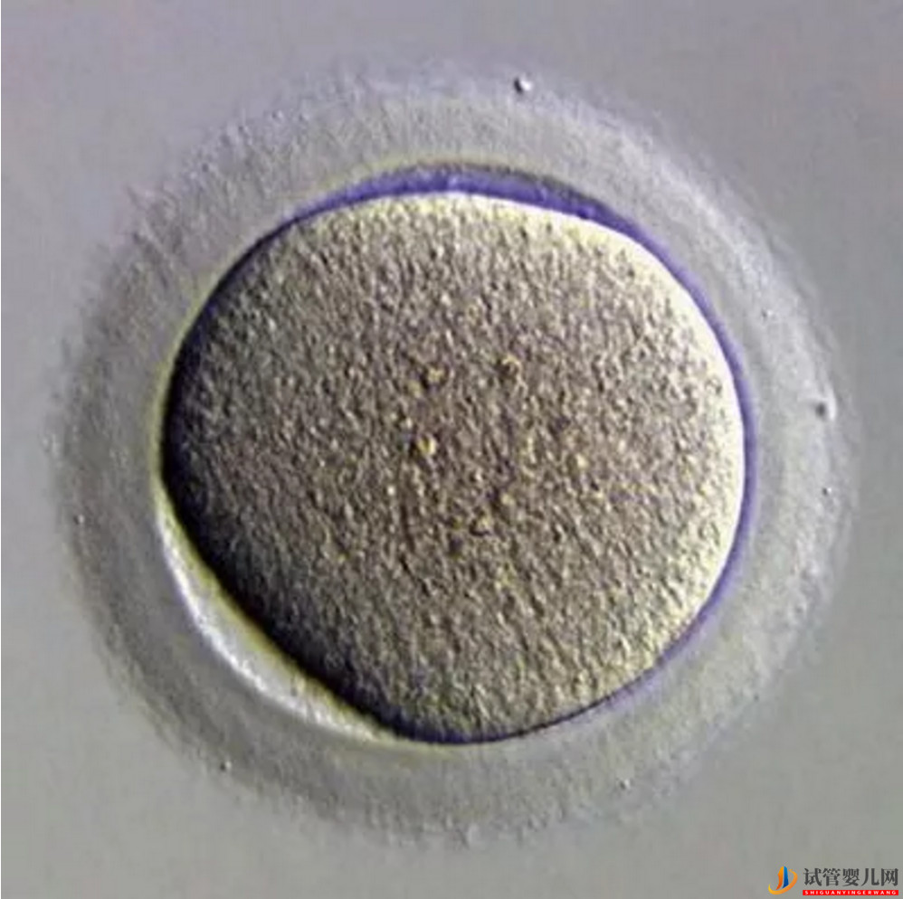 做试管婴儿促排卵是一种什么样的体验?(图1) 做试管婴儿促排卵是一种什么样的体验?(图1)