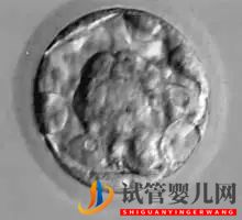美国试管婴儿_这样的囊胚才是极好的(图9) 美国试管婴儿_这样的囊胚才是极好的(图9)