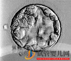 美国试管婴儿_这样的囊胚才是极好的(图17) 美国试管婴儿_这样的囊胚才是极好的(图17)