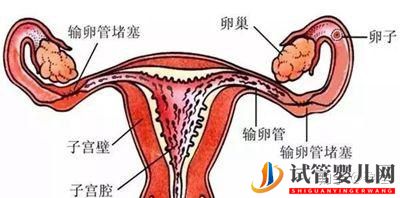输卵管堵塞还想怀宝宝!能够做泰国试管婴儿吗(图1) 输卵管堵塞还想怀宝宝!能够做泰国试管婴儿吗(图1)