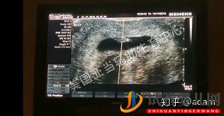 试管婴儿宝宝VS自然受孕宝宝(图1) 试管婴儿宝宝VS自然受孕宝宝(图1)