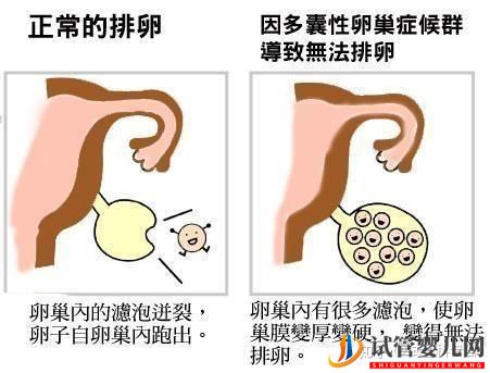 试管婴儿成功诞生有多难(图6) 试管婴儿成功诞生有多难(图6)