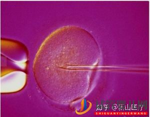 试管婴儿几代好一代、二代、三代先辨别清楚(图5) 试管婴儿几代好一代、二代、三代先辨别清楚(图5)