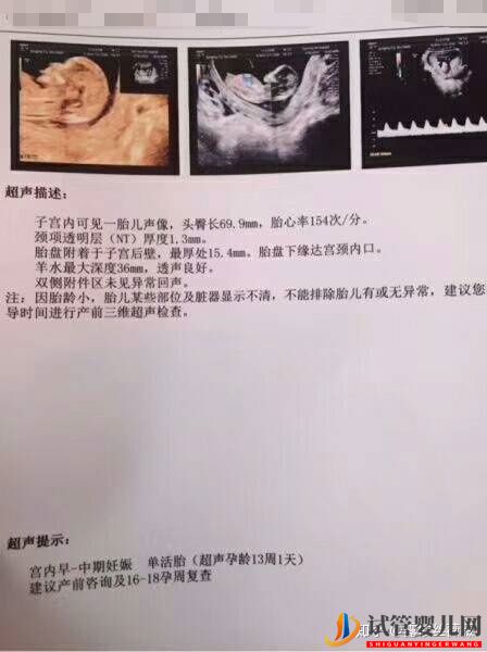 泰国试管婴儿心路历程(图4) 泰国试管婴儿心路历程(图4)