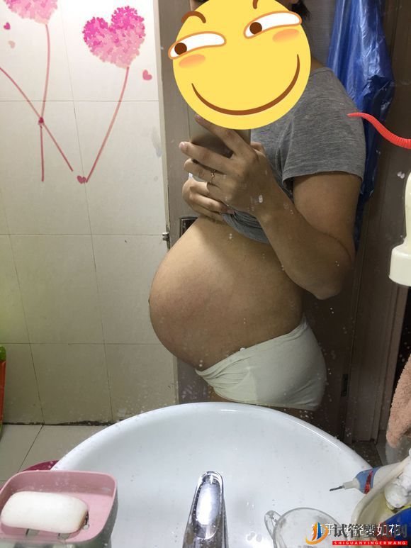认真脸我觉得泰国试管技术真的不错(图3) 认真脸我觉得泰国试管技术真的不错(图3)