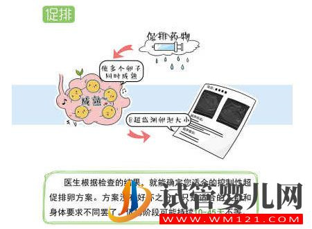 试管婴儿流程步骤说明 试管婴儿流程步骤说明(图3)