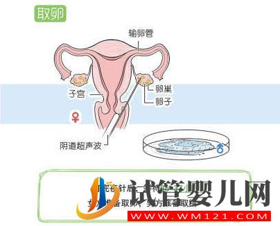 试管婴儿流程步骤说明 试管婴儿流程步骤说明(图7)