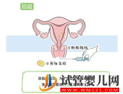 试管婴儿流程步骤说明 试管婴儿流程步骤说明(图8)