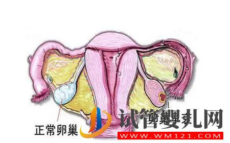 卵巢早衰备孕这么做!(图1) 卵巢早衰备孕这么做(图1)
