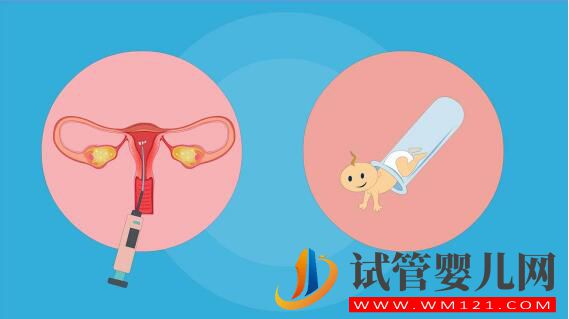人工授精和试管婴儿详细介绍及对比?(图3) 人工授精和试管婴儿详细介绍及对比?(图3)