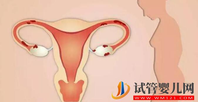 卵巢功能不好能做试管婴儿吗?(图2) 卵巢功能不好能做试管婴儿吗?(图2)