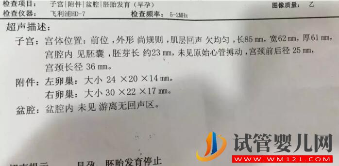 胎停育后能再次怀孕吗?(图2) 胎停育后能再次怀孕吗?(图2)