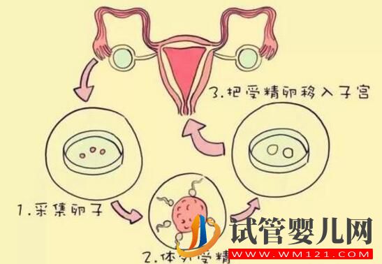 哪些因素影响试管婴儿移植的成功?(图2) 哪些因素影响试管婴儿移植的成功?(图2)