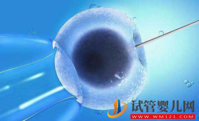 做试管婴儿整个环节有哪些?(图1) 做试管婴儿整个环节有哪些?(图1)