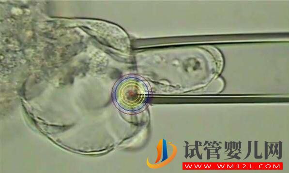 人工授精多次失败后还可以做试管婴儿吗?(图5) 人工授精多次失败后还可以做试管婴儿吗?(图5)