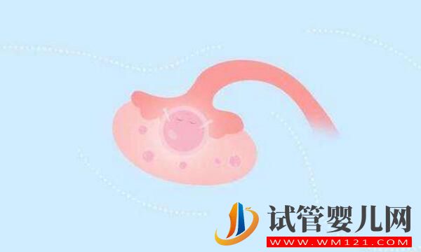 做试管婴儿促排出现空卵泡是为什么?该怎么办(图3) 做试管婴儿促排出现空卵泡是为什么?该怎么办(图3)