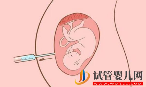 女性40岁适合做试管婴儿吗?做试管需要注意什么(图3) 女性40岁适合做试管婴儿吗?做试管需要注意什么(图3)
