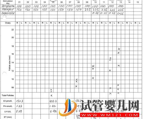 左侧卵巢被割除、三次试管失败她该怎么办?(图5) 左侧卵巢被割除、三次试管失败她该怎么办?(图5)