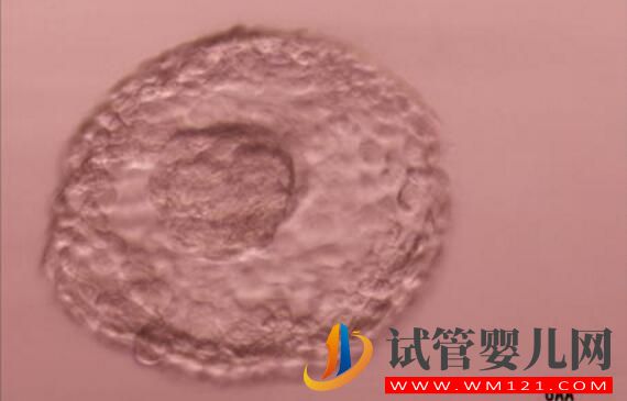 试管婴儿养囊胚是什么样的?什么样的囊胚质量好?(图2) 试管婴儿养囊胚是什么样的?什么样的囊胚质量好?(图2)