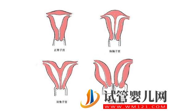 子宫偏小的女性做试管婴儿吗?来看看吧(图1) 子宫偏小的女性做试管婴儿吗?来看看吧(图1)