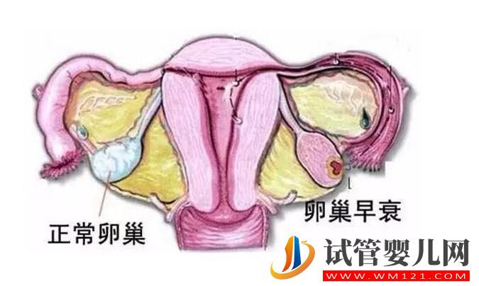 高龄女性卵巢功能低,试管手术可以做吗(图1) 高龄女性卵巢功能低,试管手术可以做吗(图1)