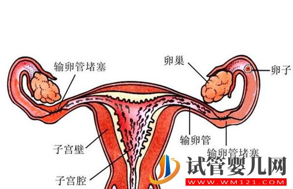 输卵管积水会对试管婴儿成功率造成影响吗?(图1) 输卵管积水会对试管婴儿成功率造成影响吗?(图1)