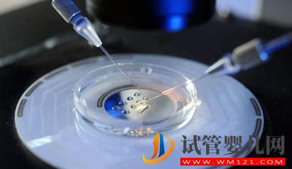 试管婴儿促排不会选择方案 一文加深你对促排卵方案的了(图5) 试管婴儿促排不会选择方案 一文加深你对促排卵方案的了(图5)
