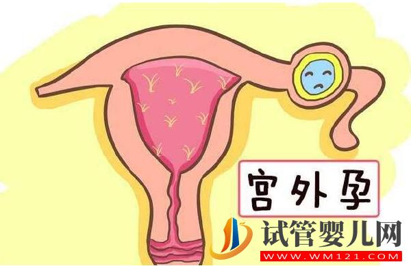 试管婴儿会发生宫外孕吗?到底能否避免呢(图1) 试管婴儿会发生宫外孕吗?到底能否避免呢(图1)