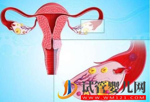 卵巢早衰怎样调理做试管？(图1)