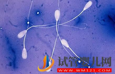 试管婴儿的流程是怎样的?需要做什么准备?要注意什么?(图3) 试管婴儿的流程是怎样的?需要做什么准备?要注意什么?(图3)