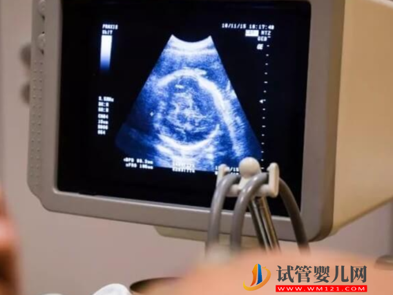 羊穿查出胚胎2号染色体基因突变会有哪些不良症状？