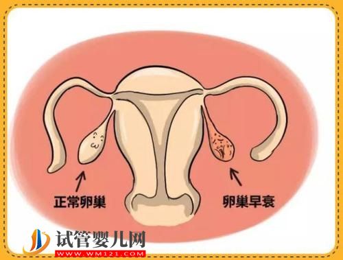 输精管堵塞或许是跟这些原因有关，请记得远离！(图1)