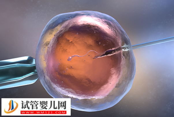 日本做试管婴儿成功率非常高，拥有先进的科技设备和设施