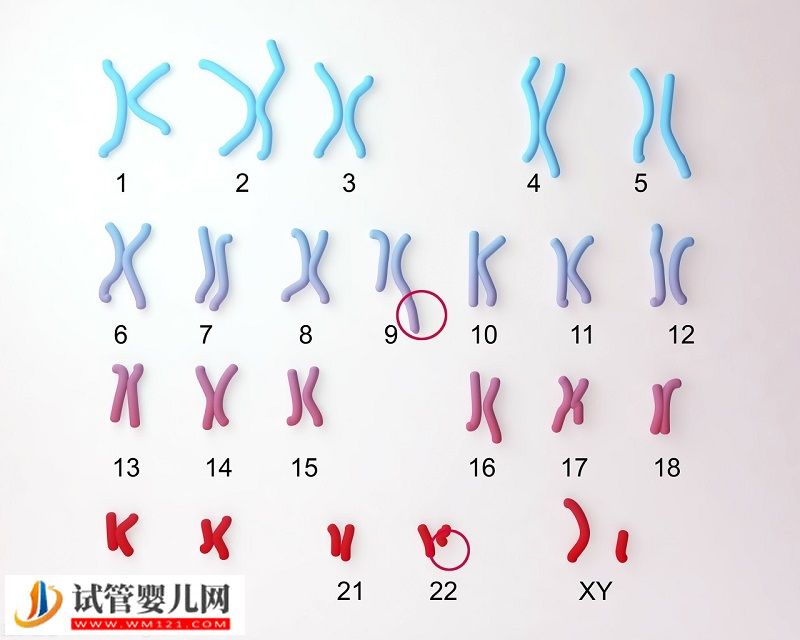 22号染色体缺失能做三代试管吗