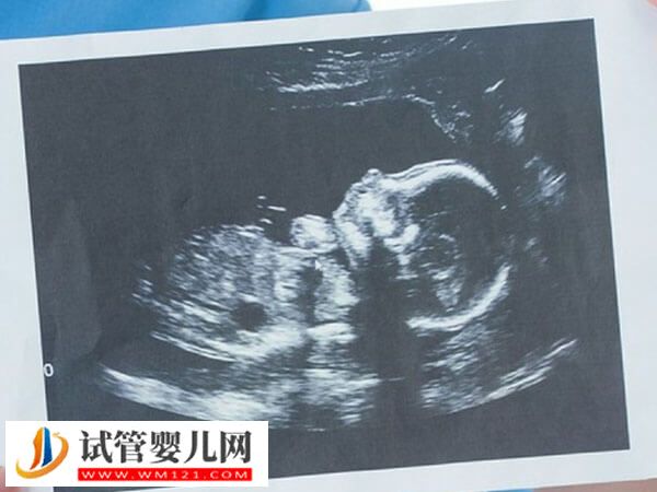 上海集爱医院助孕步骤分享，挂号到验孕流程汇总