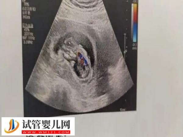 唐山做人工授精有哪些步骤