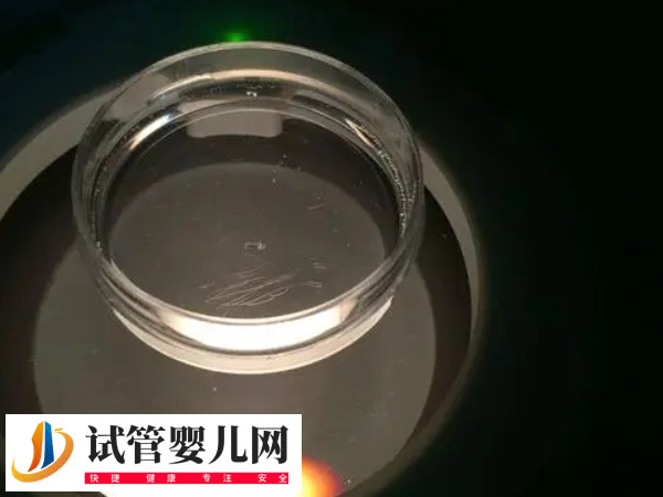 飞机杯取精做试管婴儿有危险不