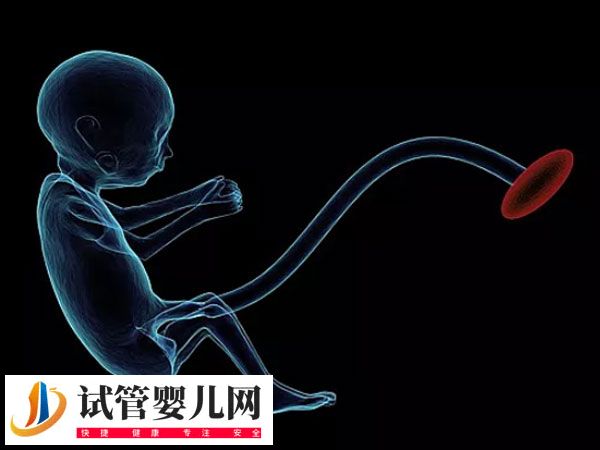 试管出生双胞胎的健康与什么有关