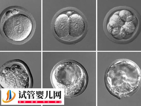 做试管怎么挑选好胚胎
