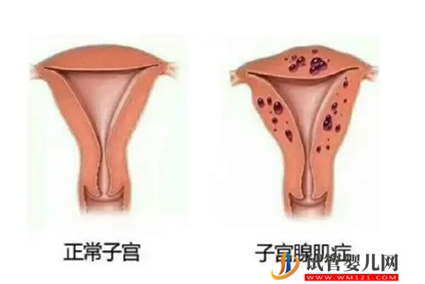 2025年上海六院供卵试管流程有哪些？申请卵源时间长做好心理准备